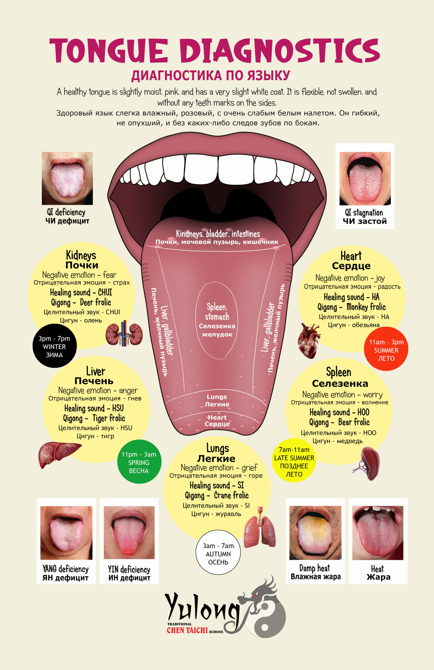 Tongue Diagnostics Traditional Chinese Medicine - Russian Language ...